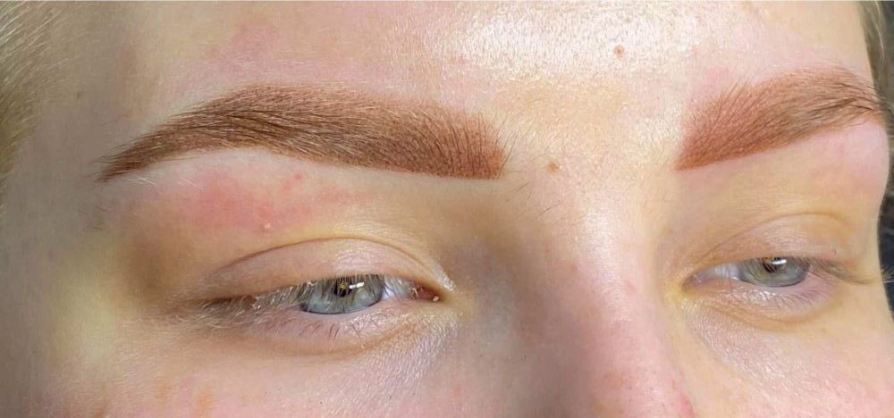 Efter 1 behandling